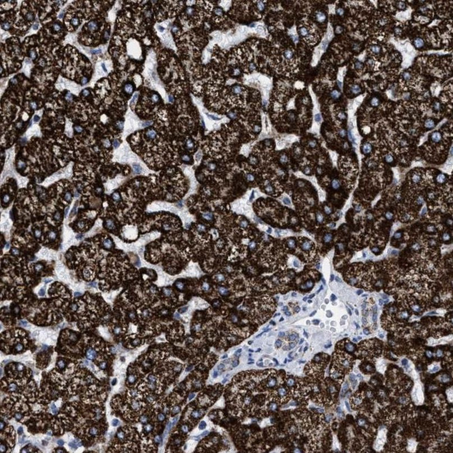 ACADS Antibody in Immunohistochemistry (IHC)