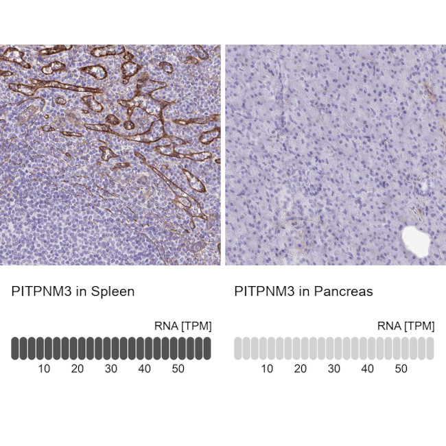 PITPNM3 Antibody in Immunohistochemistry (IHC)