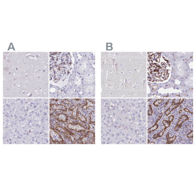 PITPNM3 Antibody in Immunohistochemistry (IHC)