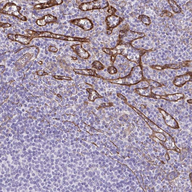 PITPNM3 Antibody in Immunohistochemistry (IHC)