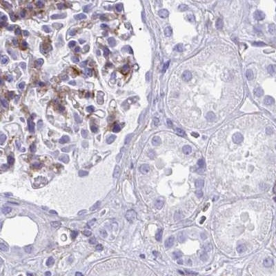 PITPNM3 Antibody in Immunohistochemistry (IHC)