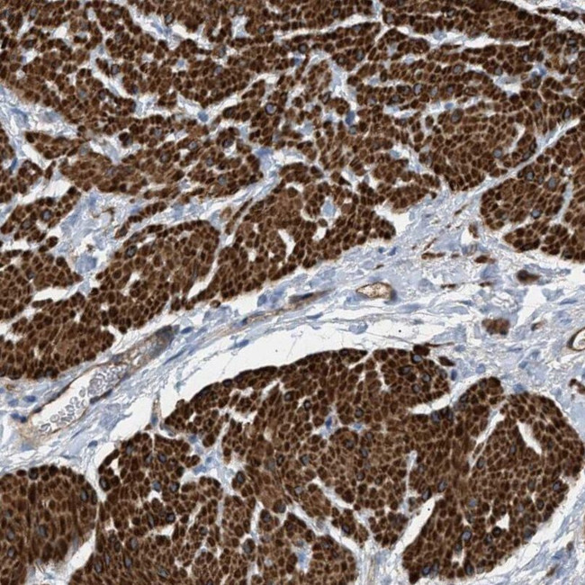 GARNL3 Antibody in Immunohistochemistry (IHC)