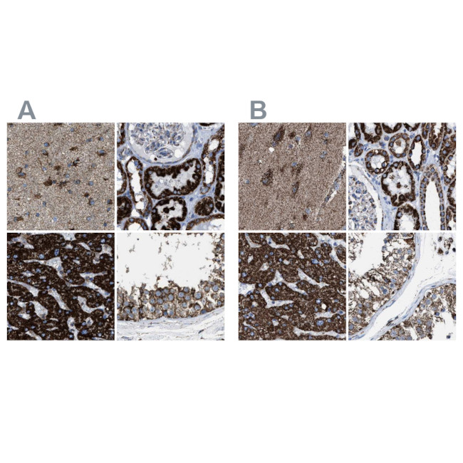 ECHS1 Antibody in Immunohistochemistry (IHC)