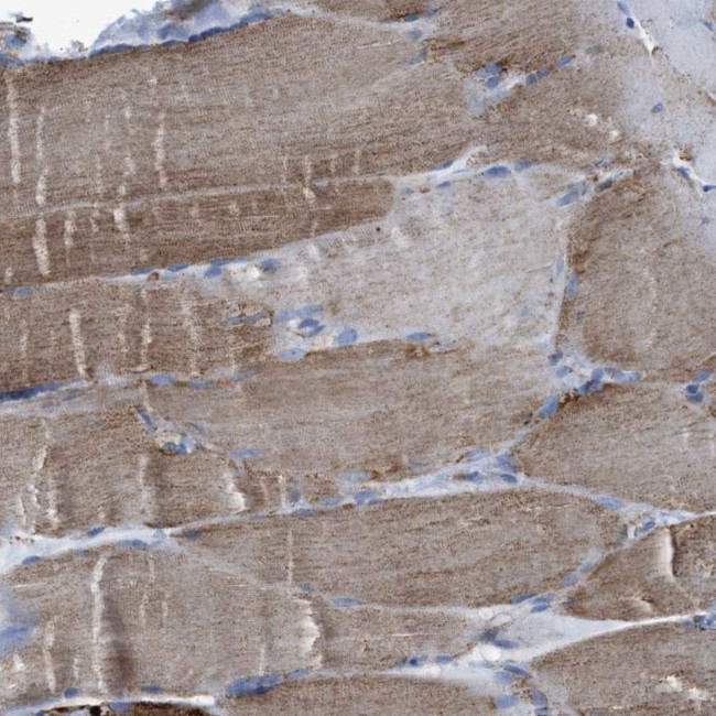 ECHS1 Antibody in Immunohistochemistry (IHC)