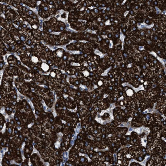 ECHS1 Antibody in Immunohistochemistry (IHC)