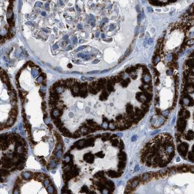 ECHS1 Antibody in Immunohistochemistry (IHC)