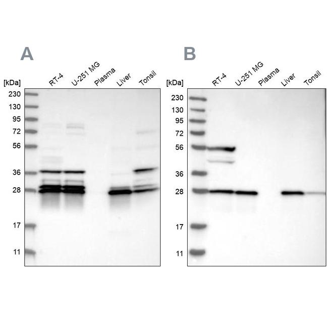 ECHS1 Antibody in Western Blot (WB)