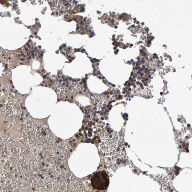 PGS1 Antibody in Immunohistochemistry (IHC)