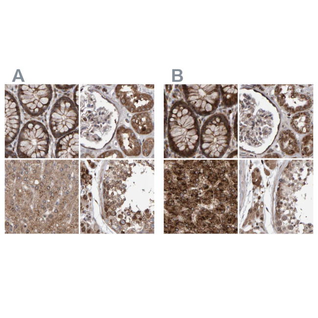 PECR Antibody in Immunohistochemistry (IHC)