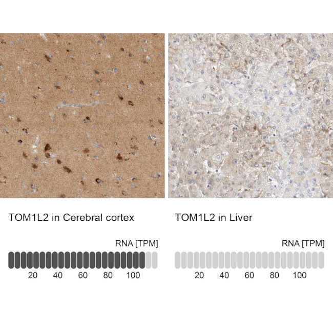 TOM1L2 Antibody in Immunohistochemistry (IHC)