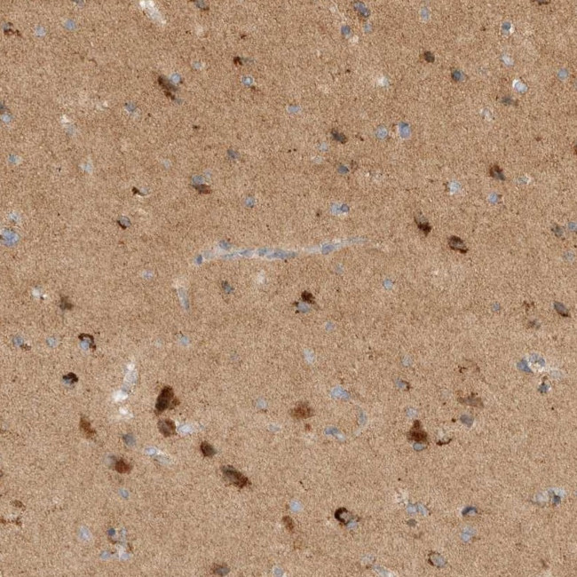 TOM1L2 Antibody in Immunohistochemistry (IHC)