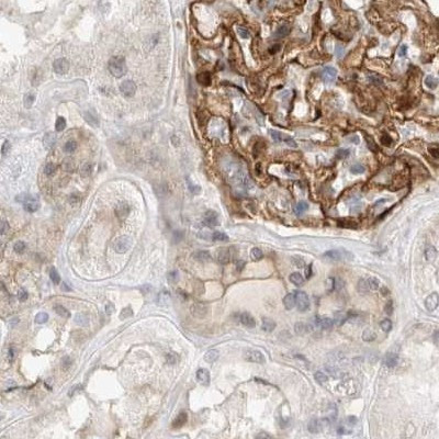 TOM1L2 Antibody in Immunohistochemistry (IHC)