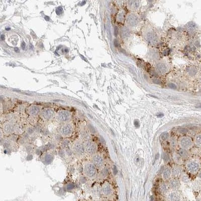 TOM1L2 Antibody in Immunohistochemistry (IHC)