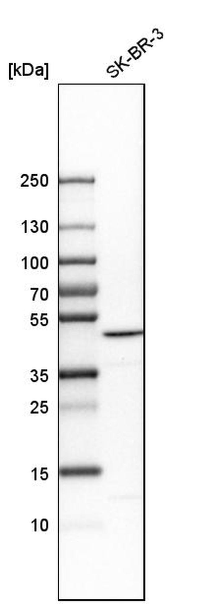 BZW2 Antibody in Western Blot (WB)