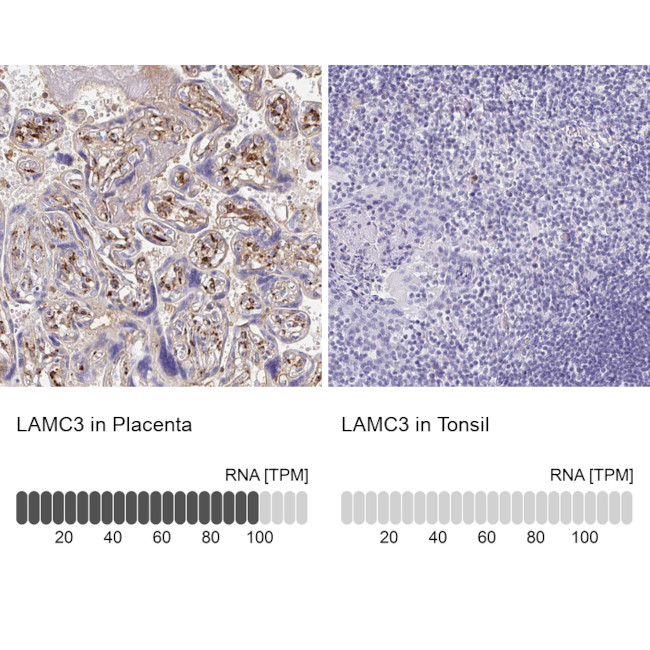 Laminin gamma-3 Antibody in Immunohistochemistry (IHC)