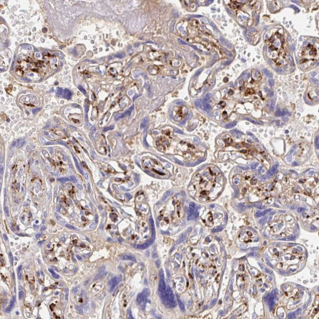 Laminin gamma-3 Antibody in Immunohistochemistry (IHC)