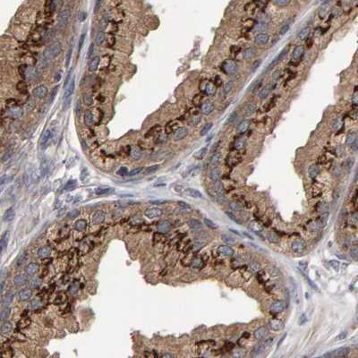 CANT1 Antibody in Immunohistochemistry (IHC)