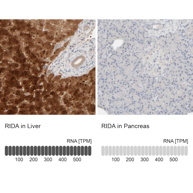 HRSP12 Antibody in Immunohistochemistry (IHC)