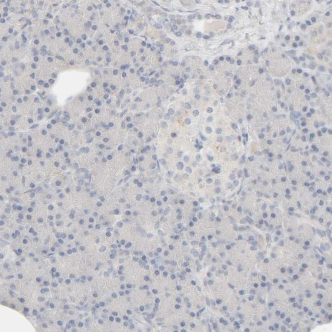 HRSP12 Antibody in Immunohistochemistry (IHC)