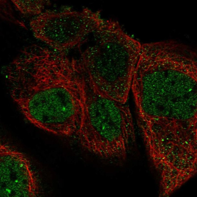 PFAS Antibody in Immunocytochemistry (ICC/IF)