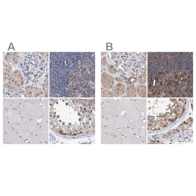 PFAS Antibody in Immunohistochemistry (IHC)