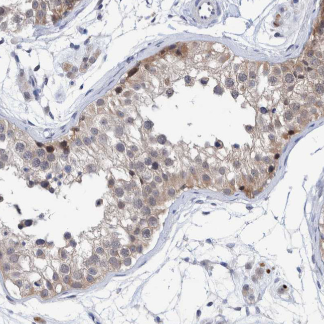 PFAS Antibody in Immunohistochemistry (IHC)