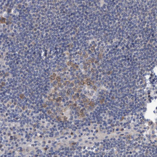 PFAS Antibody in Immunohistochemistry (IHC)