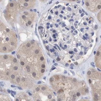 PFAS Antibody in Immunohistochemistry (IHC)