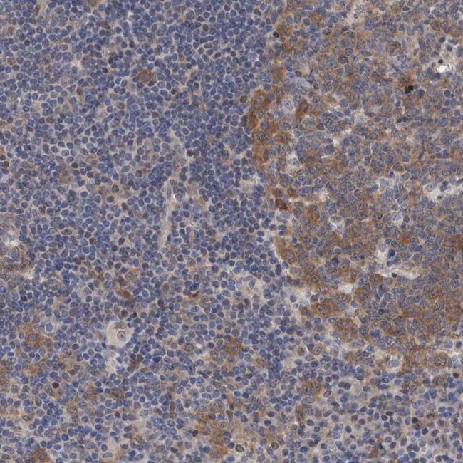 PFAS Antibody in Immunohistochemistry (IHC)