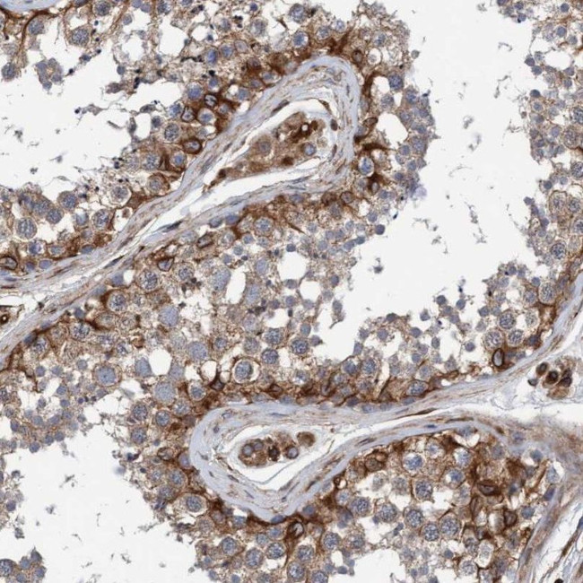 Synip Antibody in Immunohistochemistry (IHC)