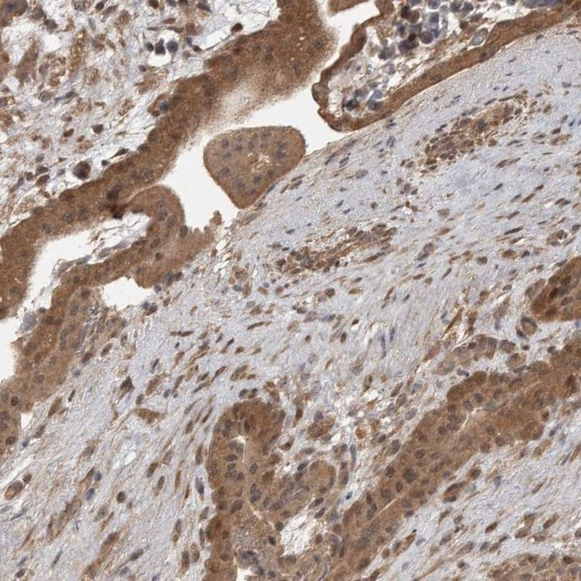 LLGL1 Antibody in Immunohistochemistry (IHC)