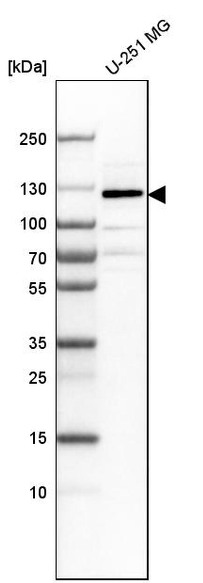 LLGL1 Antibody in Western Blot (WB)