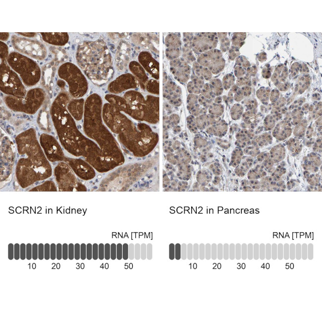 SCRN2 Antibody in Immunohistochemistry (IHC)