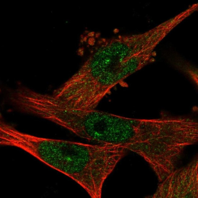 DCAF7 Antibody in Immunocytochemistry (ICC/IF)