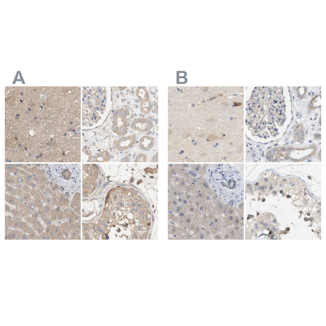 DCAF7 Antibody in Immunohistochemistry (IHC)