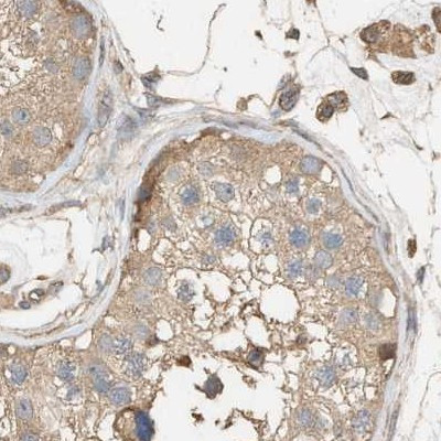 DCAF7 Antibody in Immunohistochemistry (IHC)