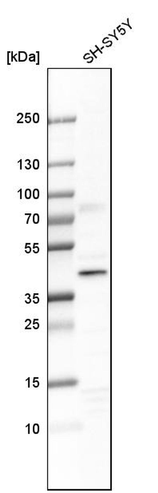 DCAF7 Antibody in Western Blot (WB)