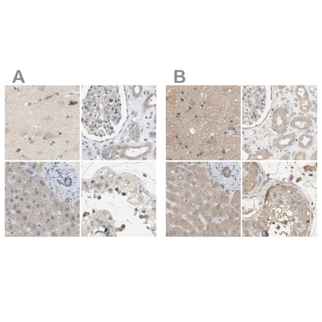 DCAF7 Antibody in Immunohistochemistry (IHC)