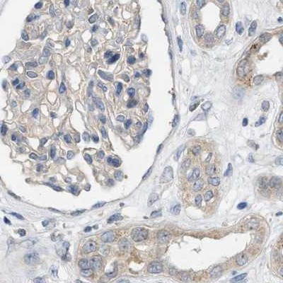 DCAF7 Antibody in Immunohistochemistry (IHC)