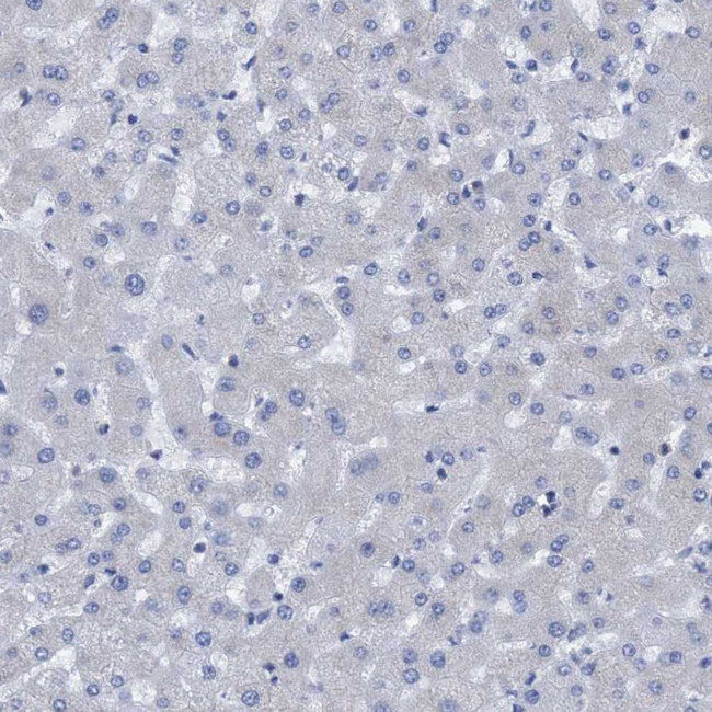 NMT1 Antibody in Immunohistochemistry (IHC)