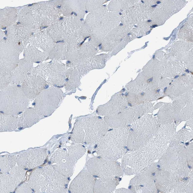 NMT1 Antibody in Immunohistochemistry (IHC)