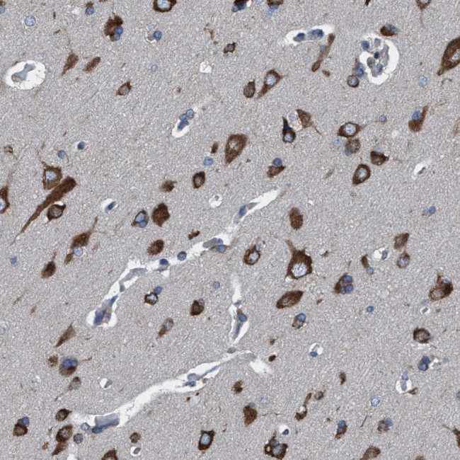 NMT1 Antibody in Immunohistochemistry (IHC)