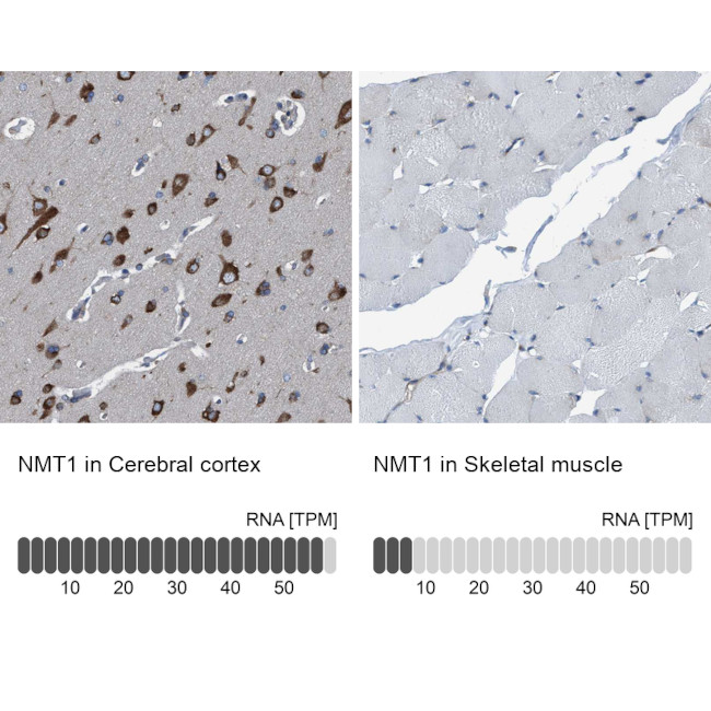 NMT1 Antibody