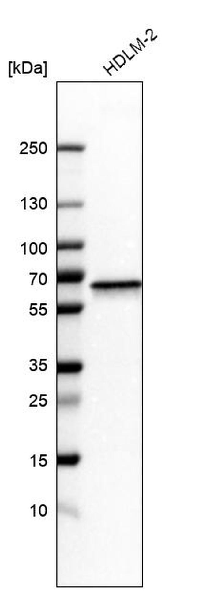 NMT1 Antibody in Western Blot (WB)