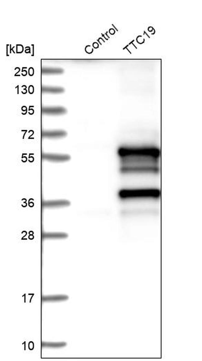 TTC19 Antibody in Western Blot (WB)