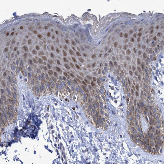 ZNF750 Antibody in Immunohistochemistry (IHC)