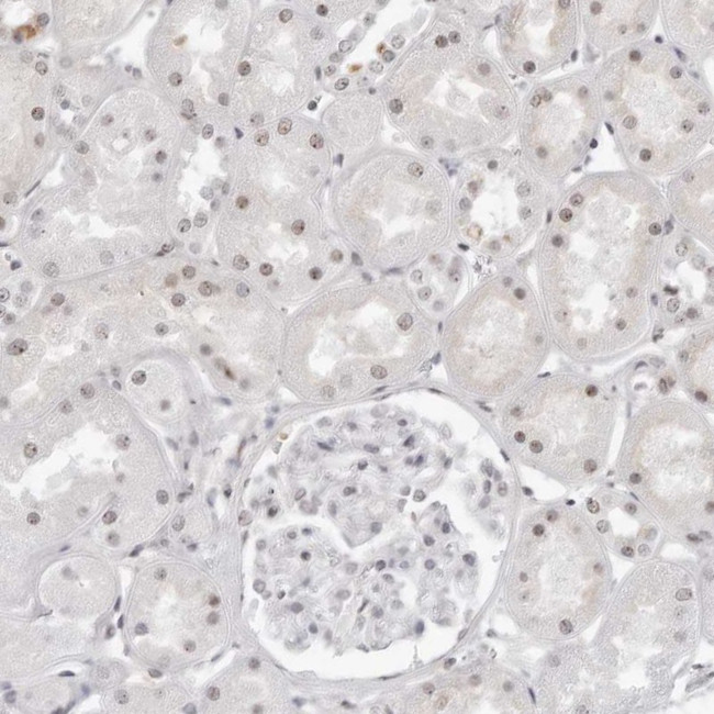 WRAP53 Antibody in Immunohistochemistry (IHC)