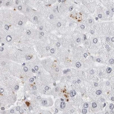 WRAP53 Antibody in Immunohistochemistry (IHC)