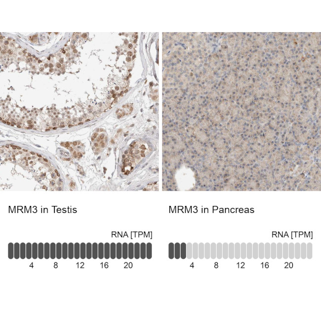 RNMTL1 Antibody in Immunohistochemistry (IHC)