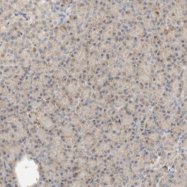 RNMTL1 Antibody in Immunohistochemistry (IHC)